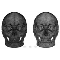 Female human skull- realistic 3d print model- 3 scales set 3D print model
